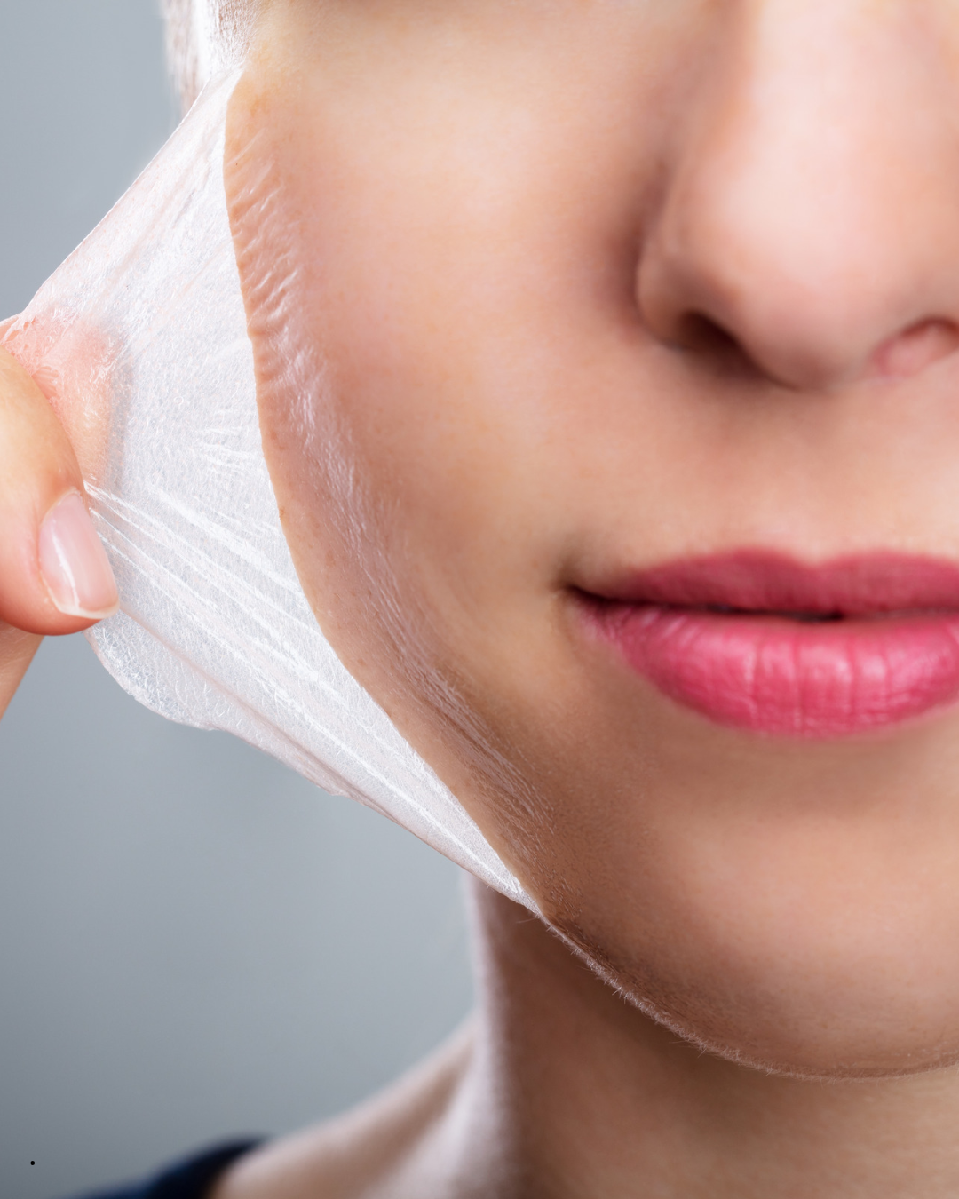 peeling grado medico
